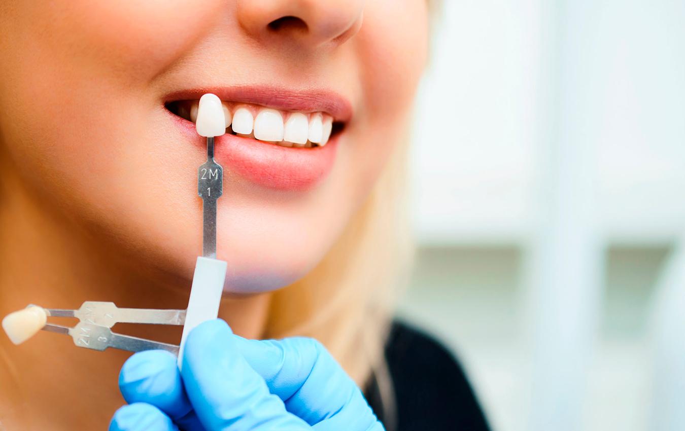 Cosmetic Dentistry in Ahmedabad