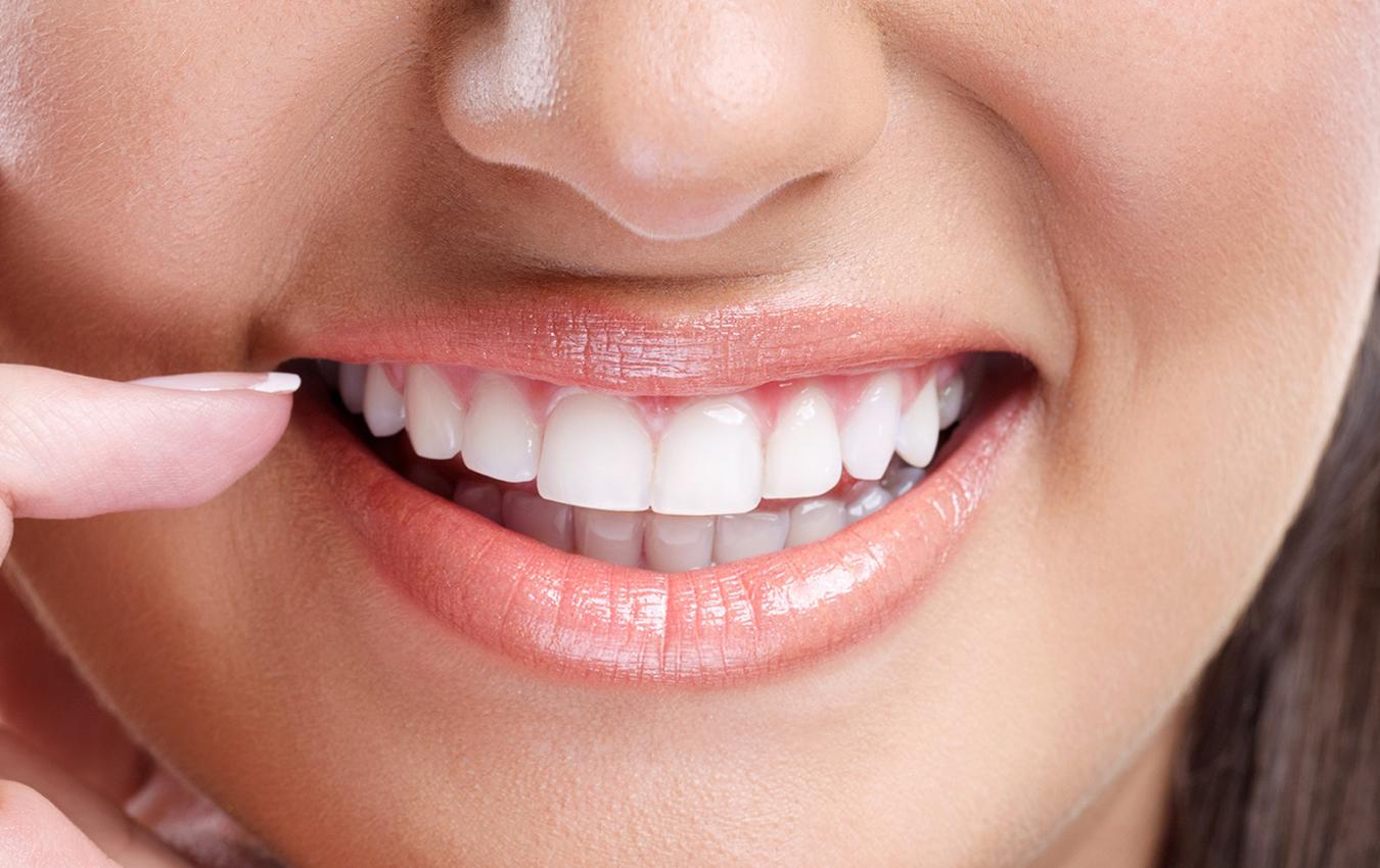 Smile Makeover Treatment Ahmedabad