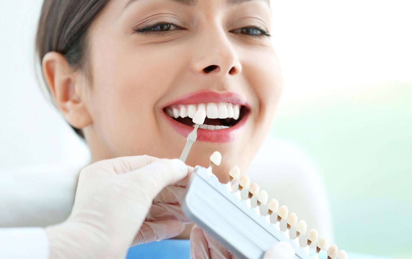 Veneers