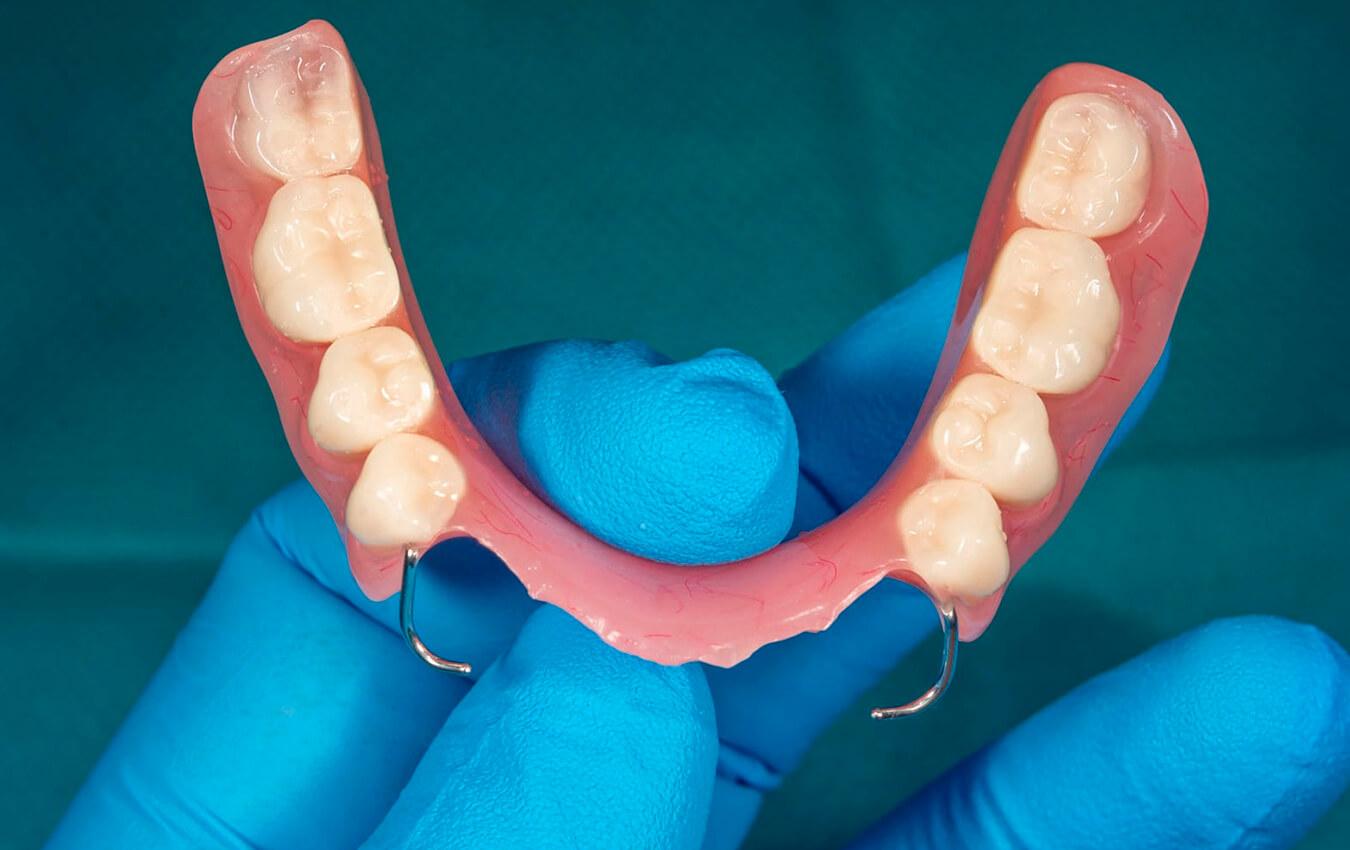 What is a Denture?