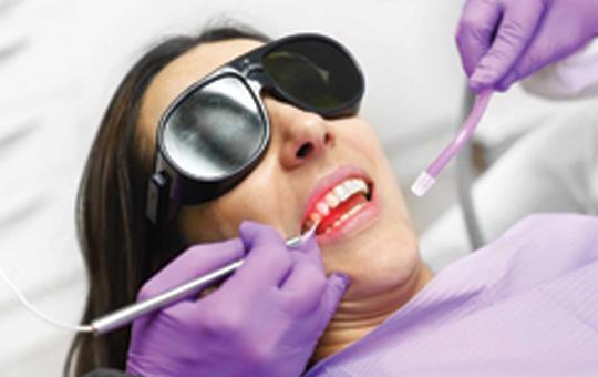 Non-Surgical Gum Treatment-2